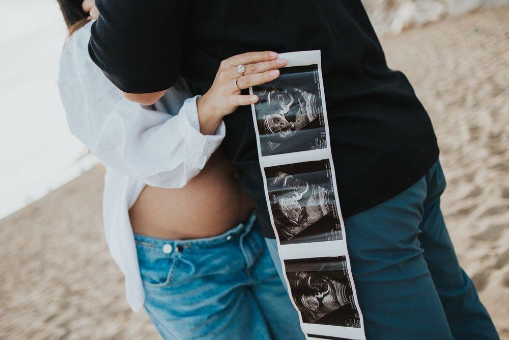 recomment-pack-image-1